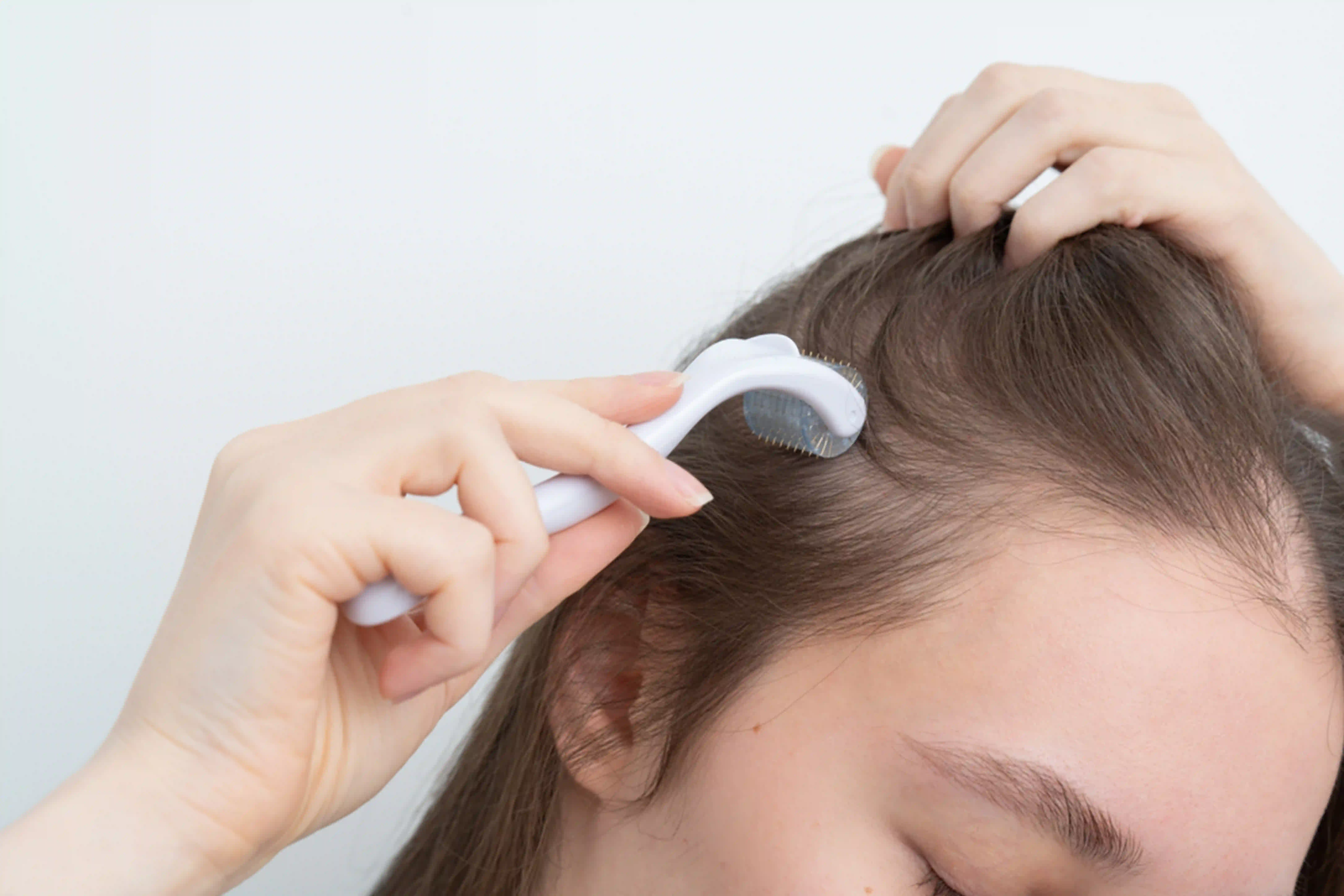 Derma Rolling for Hair Regrowth in Thrissur