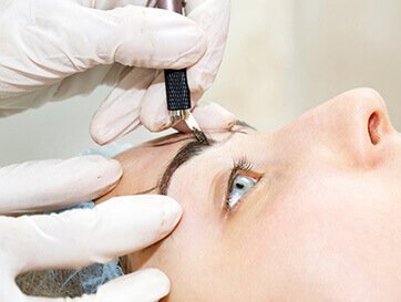  Eyebrow Loss Treatmet 