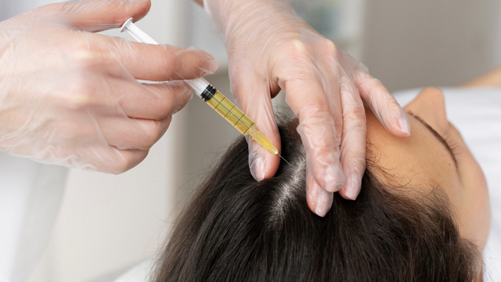 Gfc Injection Gfc hair treatment in Kerala, BEST hair clinic and PRP in Thrissur