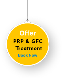 hair transplant in kerala