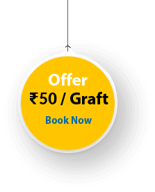 hair transplant in kerala